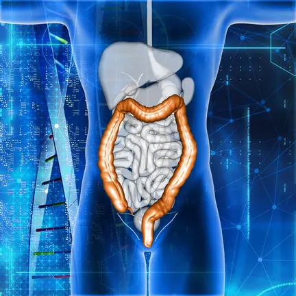 3D render of a male medical figure with colon highlighted