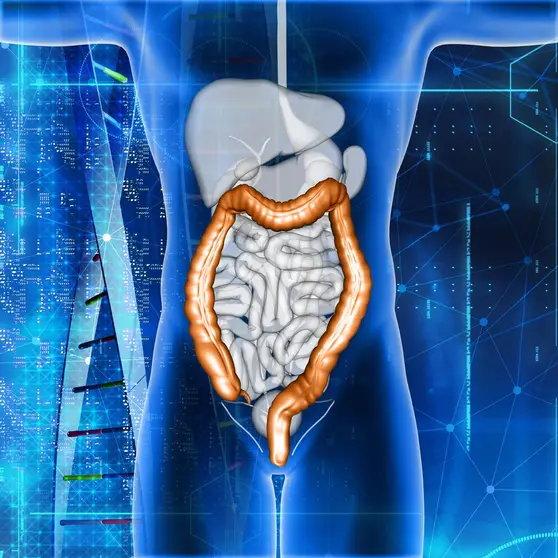 3D render of a male medical figure with colon highlighted